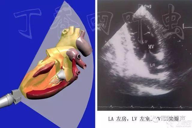 3d图解心脏解剖与心脏超声切面