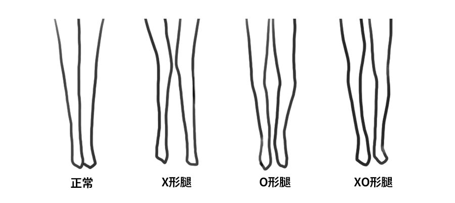 【古木夕羊 gmxy】一秒解决所有腿型问题,给你的穿搭加分