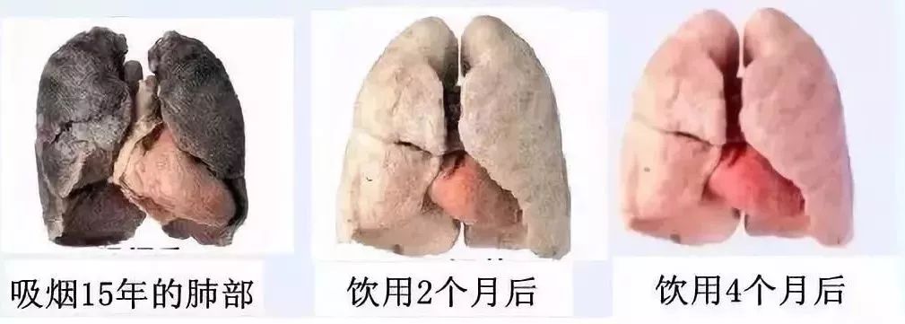 30年烟龄的"黑肺"竟然被洗干净了!每天一杯,清肺,排烟毒!