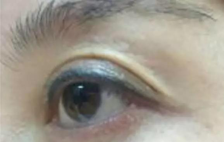 处理技巧 这一类型的老式眼线很粗,但是有一个特点就是眼线的下方