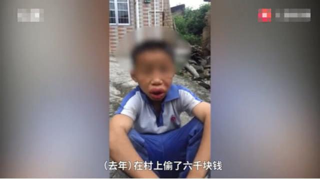 12岁男孩被爸爸打成香肠嘴，调查人员称是皮外伤，对家长批评教育
                
               