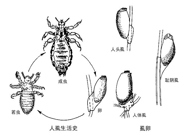 头发上有阴虱怎么办