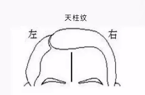 额头纹图片大全 b486840941a344ec9d4e5fc89441207f.jpeg
