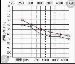 如果体检电测听检查听力下降表现符合噪声聋,应进行复查,复查后仍如此