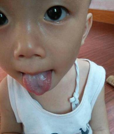 儿童吃饭后肚子疼怎么办 eba5a3cbbe394f0c8e656b85e54b950b.jpeg