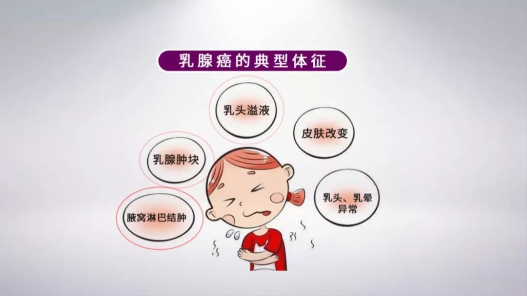 实用的乳腺癌早期自测方法让您远离日渐年轻化的乳腺癌