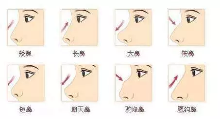 什么样的鼻子才叫做好看的呢？从美学标准来说，一个好看的鼻子评判标准