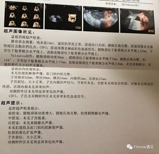 教你如何看懂盆底肌检查报告