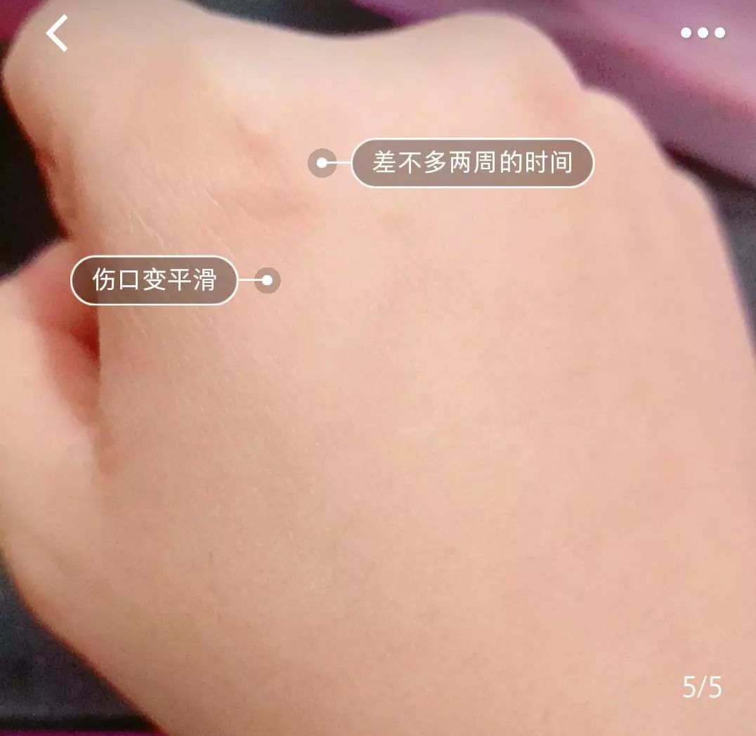 1c6c7ce76ac24c08a4c38d700bc50595.jpeg