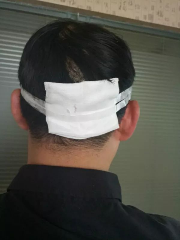蹊跷!37岁男子在饭店莫名失忆半分钟,醒来一摸头,满手鲜血…… 国际白金会娱乐