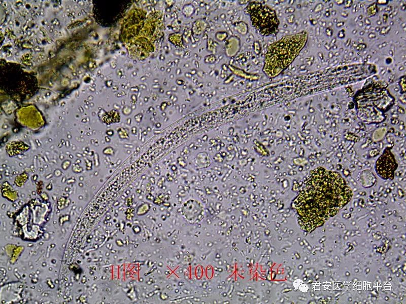 粪类圆线虫和人芽囊原虫