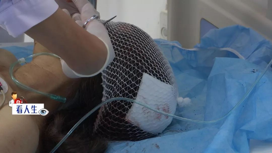 啥是开放性伤口 0c2c72644db94620904fa3eef64d7870.jpeg