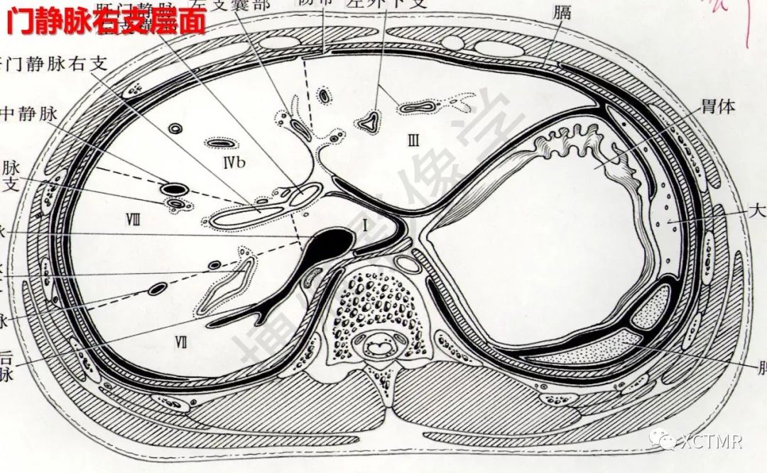 肝脏分叶分段的影像学解剖