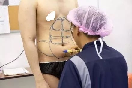 比隆胸、隆鼻更可怕的,是男人隆腹肌...... ibet国际平台登陆地址