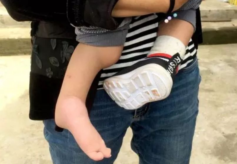 【惊呆】两次产检没问题,孩子出生后吓到了!现在只能爬行... 亚洲熟HD视频