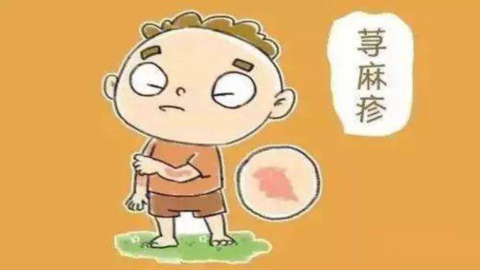 有一些患者身上出现了"风疙瘩",其实是发生了急性荨麻疹.
