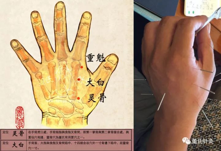 按什么穴位止鼻涕 2fc294250a22450899ed90d5fface161.jpeg