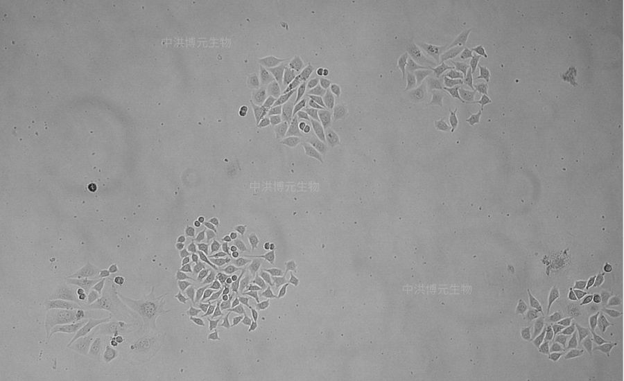 实验专栏丨细胞克隆实验做不好来这取取经