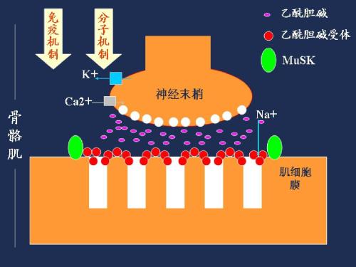 重症肌无力的治疗方法以及去哪家医院好?