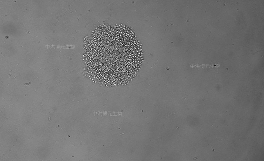 hep3b细胞平板克隆(中洪实拍,盗者必究)