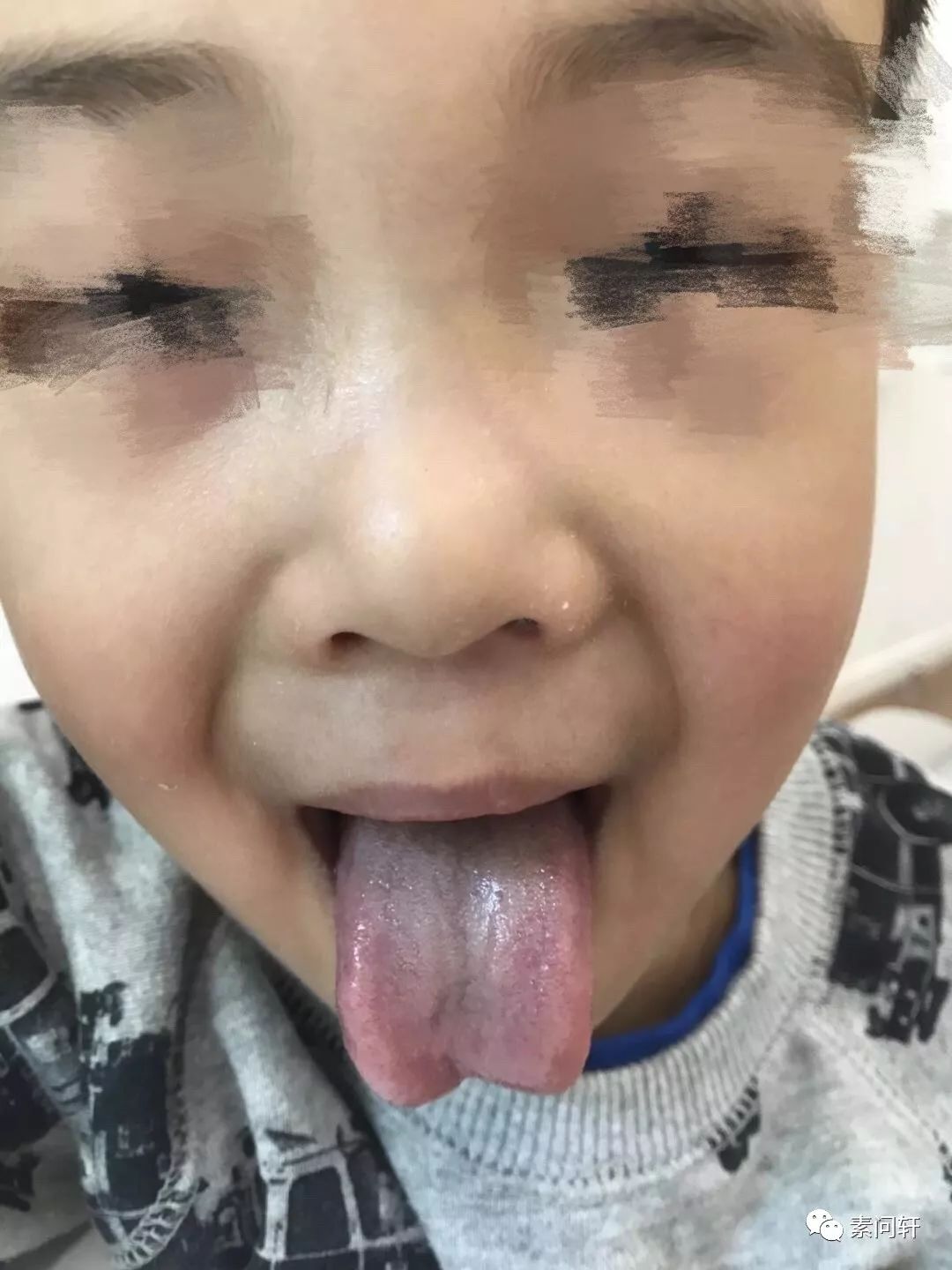 咳嗽时怎么判断风寒还是风热?没学会看舌头就