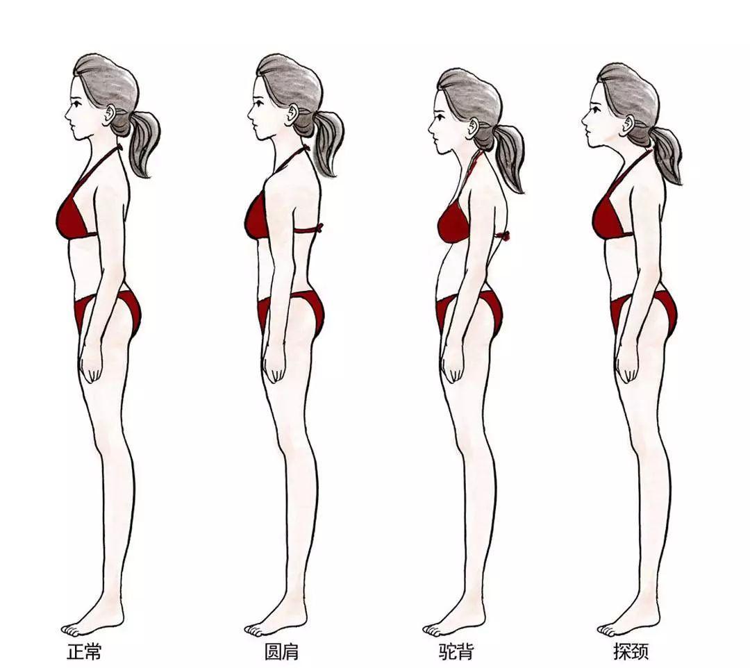 再加上后背部肌群的薄弱,所以大胸一般都伴随着驼背