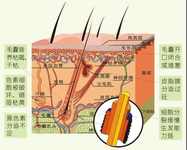 御发坞:年纪轻轻就有了白发,难道是早衰了吗?_黑色素