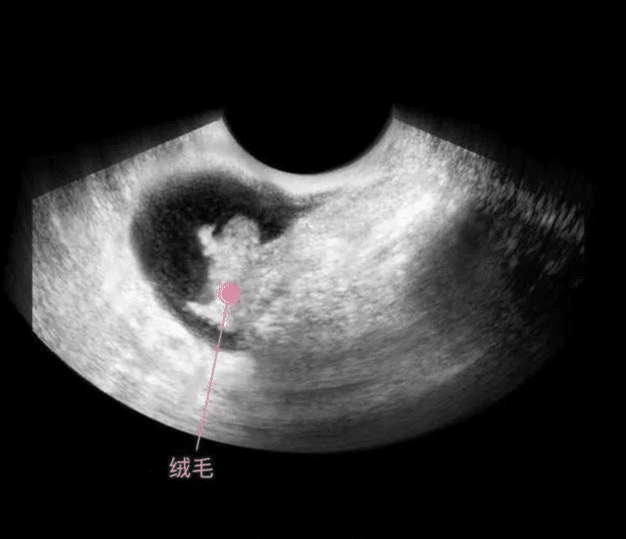 胎儿从卵泡到性别形成, 17张图片清晰诠释, 男宝女宝看得很清楚