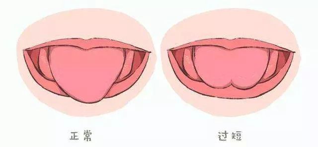 成语气什么舌_等什么君(2)