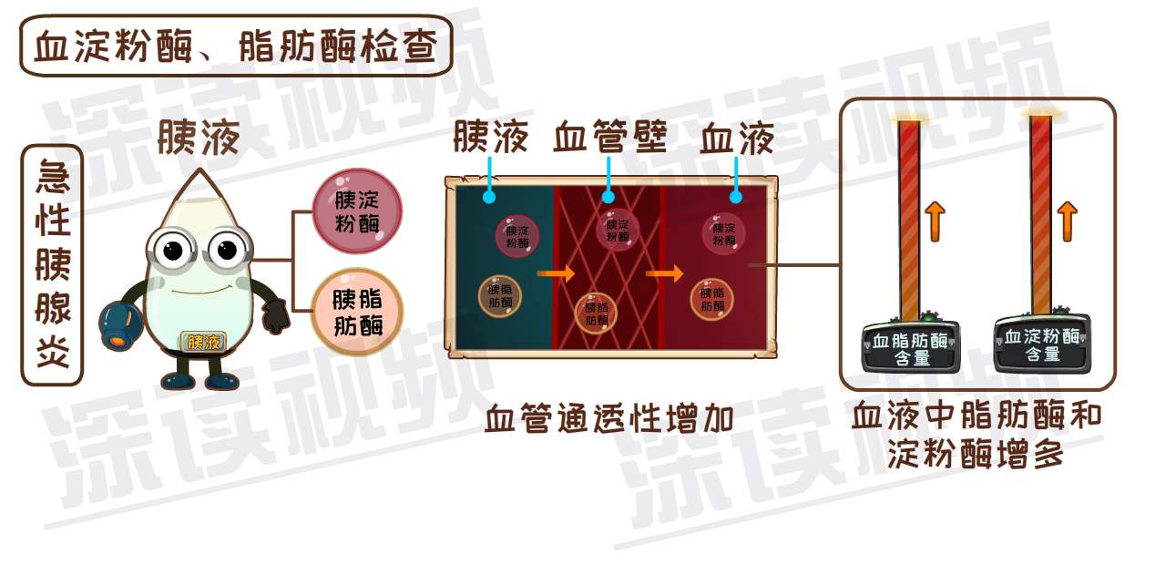 急性胰腺炎时,胰脂肪酶和胰淀粉酶的数量会增加,同时在炎症的刺激下