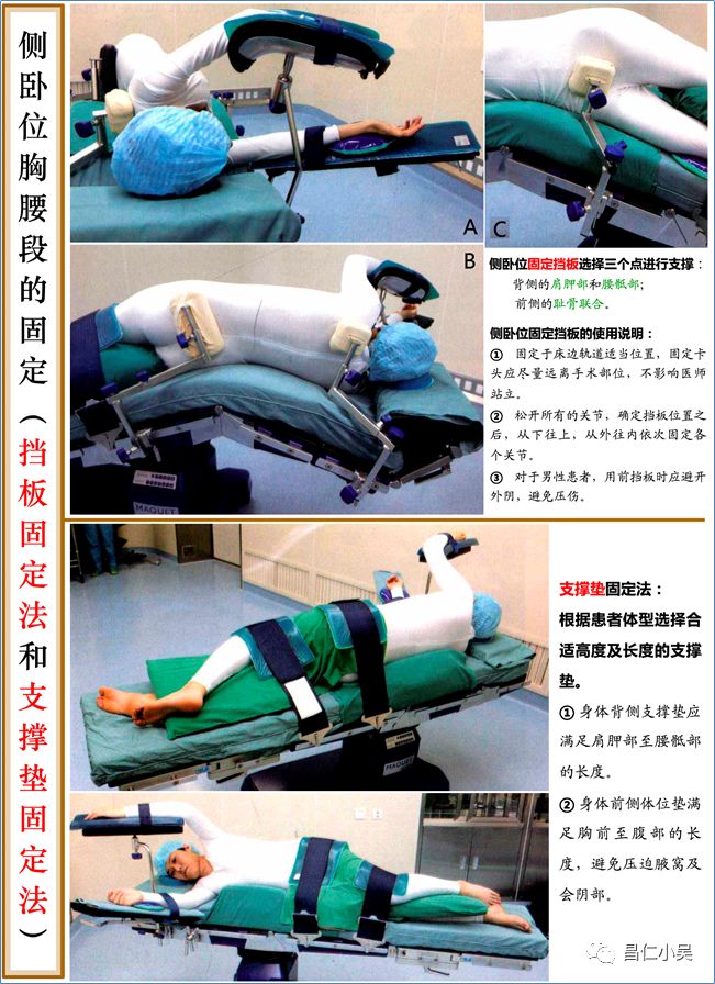 神经解剖学习笔记神外手术的体位