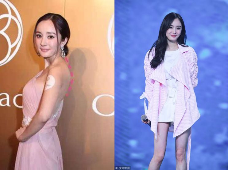 杨幂驼背治好了迪丽热巴又怎么了