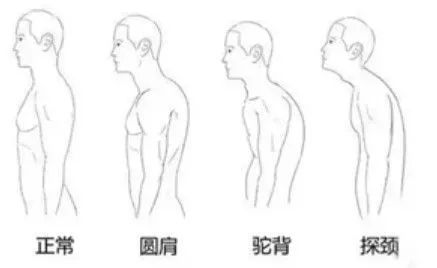 怎样才能让自己的体态变得好看点 2c748630991c45f8b821240804b0492d.jpeg