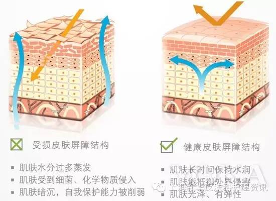 皮肤修复屏障 693c9ba509e444d990c5bc1952f8d24c.jpeg