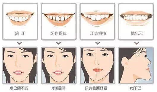 正畸牙齿移动的原理_正畸中牙齿移动的原理