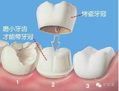 烂牙根拔出图片