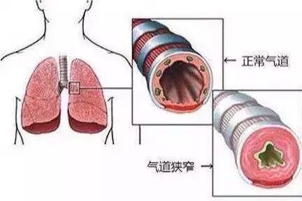 卧床病人口腔怎么护理_护理卧床病人翻身图片(3)