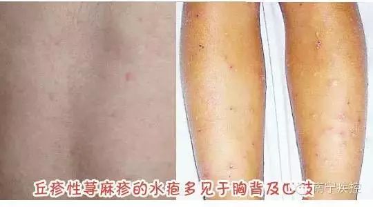 宁明有多少人口_宁明花山图片(3)