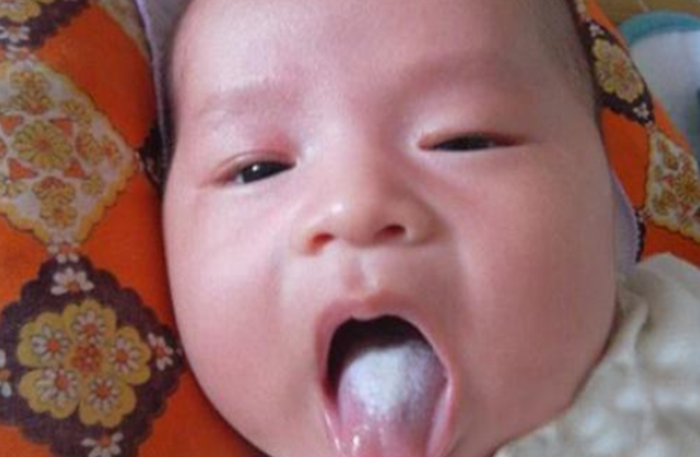                     宝宝是否出现“积食”？留意这5个“信号”，新手宝妈尤其要注意