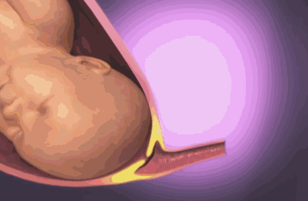 183acc871133458cbe731ec39773f0c1.gif