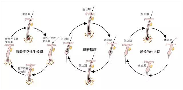 头发生长液什么原理_黛歆头发生长液(3)