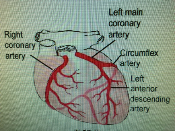这是心脏的模型图,分布在心脏表面的,红色的血管就是冠状动脉及其分支