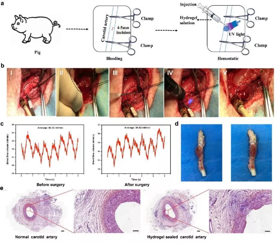 怎么快速止血大伤口 7b6cd71bd9d74b588a687b1a809730a5.jpeg