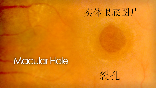e4795566c35e426593db28672781c65f.png