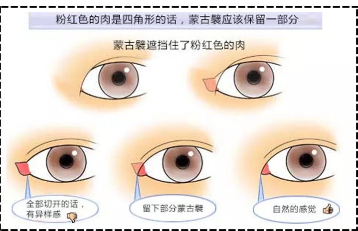 开眼角显老怎么办 f421fa038f794faeab768051a442e0ec.jpeg