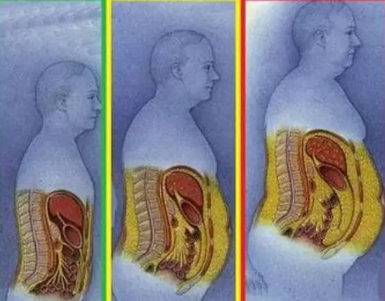 腹部脂肪危害有多大?看完吓得我赶紧去减肥了!