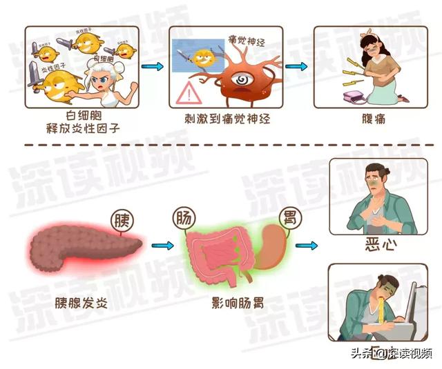 急性胰腺炎死亡率真的很高吗?