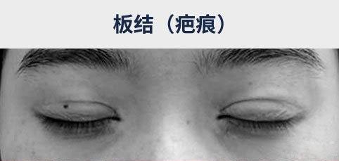 如何让眼睛恢复原来的大小 5885e984aed0420682be5e5ee83b783a.jpeg