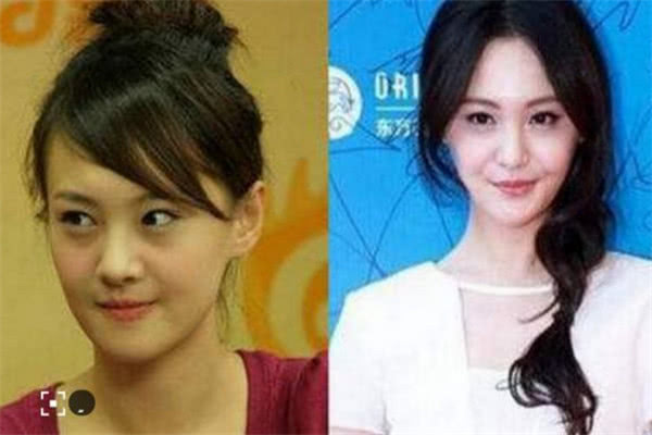 娱乐圈最不该整容的4大当红女星,最后一位太可惜,整废了 百乐宫平台