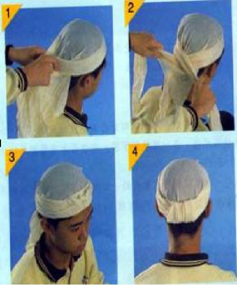 头顶帽式包扎先用无菌纱布覆盖压迫伤口,再用三角巾或绷带用力包扎